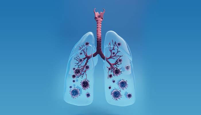 Reasons for Lung Transplant