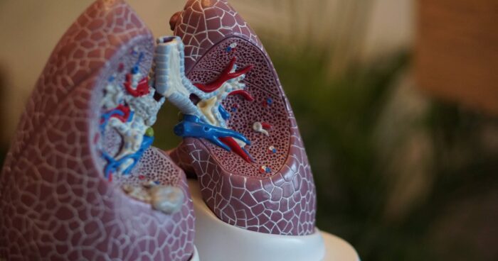 Reasons for Lung Transplant