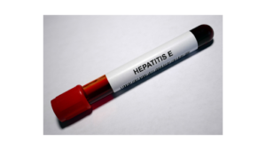 Hepatitis E diagnosis